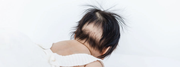 How to stop baby bald spots